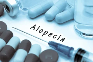 What Is the Best Treatment for Androgenic Alopecia?