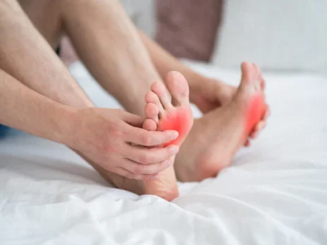 Managing Chronic Gout: Beyond Medication