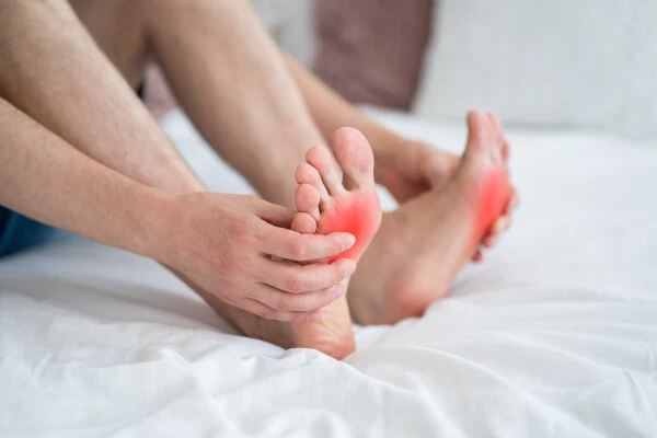 Managing Chronic Gout: Beyond Medication