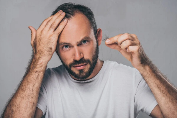 Now-enrolling-alopecia-clinical-trial-is-this-hair-loss-study-right-for-you1 - ACRC Trials Now Enrolling: Alopecia Clinical Trial – Is This Hair Loss Study Right for You?