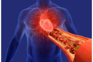 The Risks of Uncontrolled Hypertension